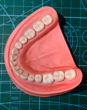 Mould of human teeth on green graphic
