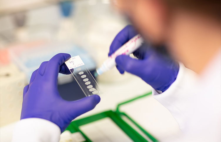 Researcher wearing protective gloves handling a microscope slide and applying a sample in a biomedical research laboratory.