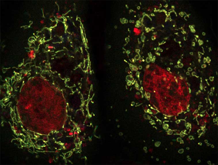 Cell imaging Cell imaging