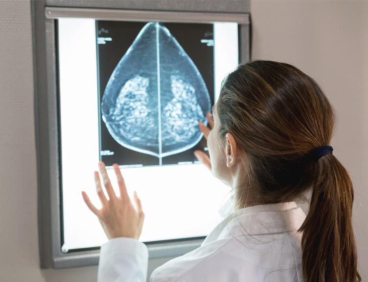 Mammogram Mammogram