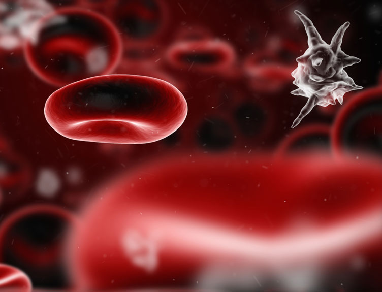 sepsis sepsis