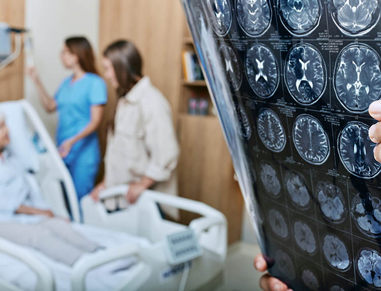 Stroke care Medical professionals interpreting a scan on a hospital ward.