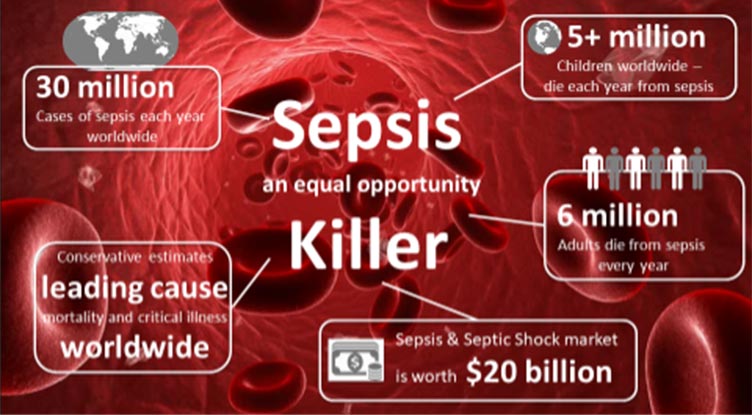 Sepsis graphic