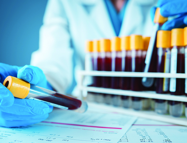 Blood tests